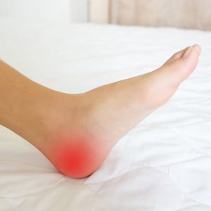 Heel Pain Won’t Go Away