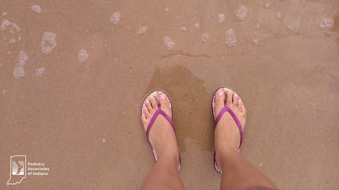 Flip Flop Season Is Here: Are Sandals Hurting Your Feet?  l Podiatry Associates of Indiana